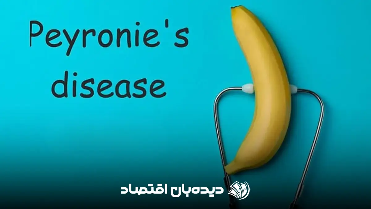 peyronie’s disease