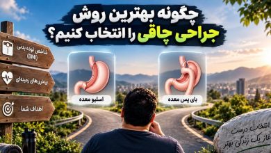 چگونه بهترین روش جراحی چاقی را انتخاب کنیم؟