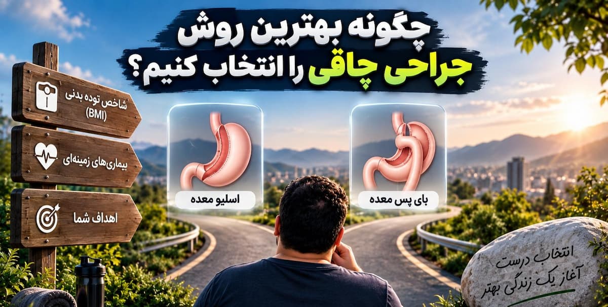 چگونه بهترین روش جراحی چاقی را انتخاب کنیم؟